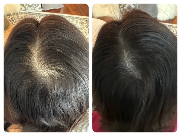 スカルプタトゥー（Before After）④|E LINDA