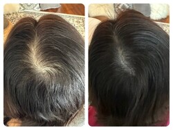 スカルプタトゥー（Before After）④|E LINDA