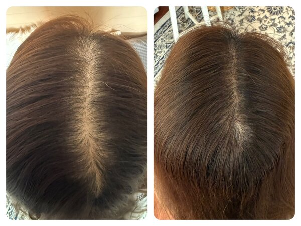 スカルプタトゥー（Before After）③|E LINDA