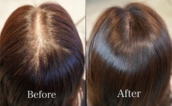 スカルプタトゥー（Before After）①|E LINDA