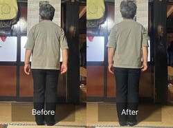 矯正施術|癒しと脱毛サロン trillium