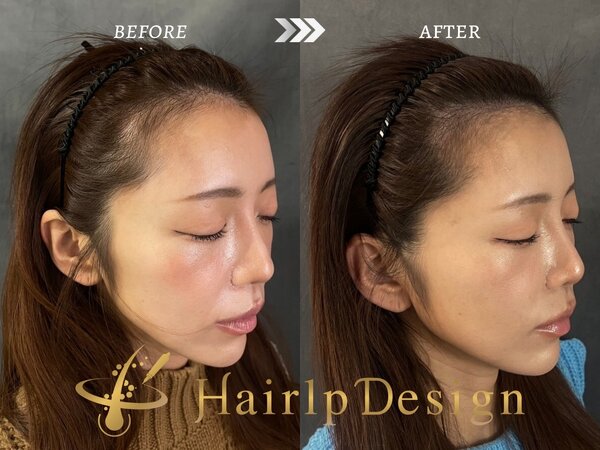 【ヘアライン】Ｍサイズ|グランモア代々木店