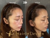 【ヘアライン】Ｍサイズ|グランモア代々木店