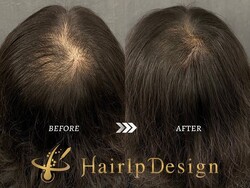 【つむじ】Ｍサイズ|グランモア代々木店