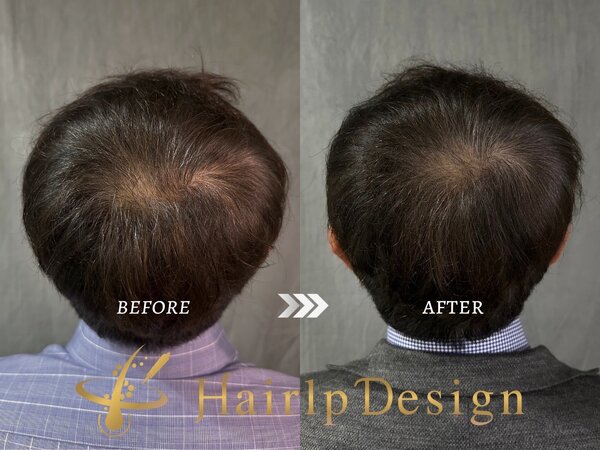 【頭頂部】Ｌサイズ|グランモア代々木店