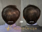 【頭頂部】Ｌサイズ|グランモア代々木店