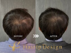 【頭頂部】Ｌサイズ|グランモア代々木店