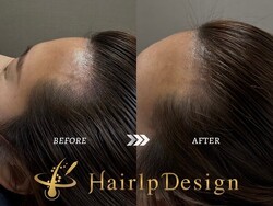 【ヘアライン】Ｍサイズ②|グランモア代々木店