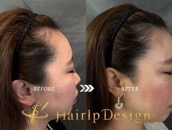 【ヘアライン】Ｍサイズ③|グランモア代々木店