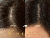 【傷跡】ＳＳサイズ|グランモア代々木店