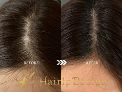 【傷跡】ＳＳサイズ|グランモア代々木店