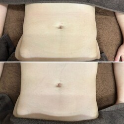 愛式メディカルリンパ　ウエスト|愛式メディカルリンパ　Calluna