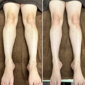 愛式メディカルリンパ　脚|愛式メディカルリンパ　Calluna