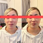 愛式メディカルリンパ　顔|愛式メディカルリンパ　Calluna