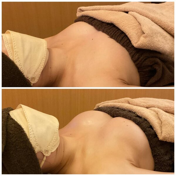 育乳バスト③|Cherir