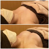 育乳バスト③|Cherir