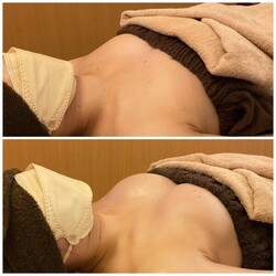 育乳バスト③|Cherir