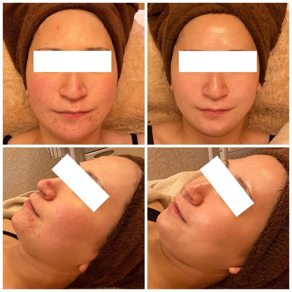 陶肌トリートメント|Cherir