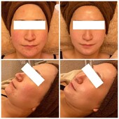 陶肌トリートメント|Cherir