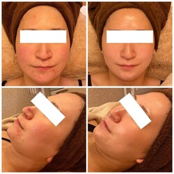 陶肌トリートメント|Cherir