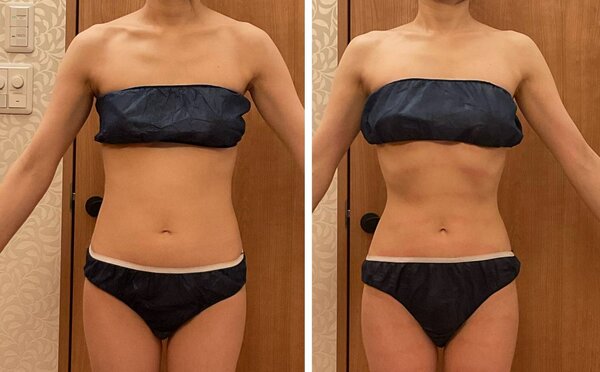 パワーレメディ痩身①|Cherir