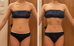 パワーレメディ痩身①|Cherir