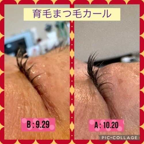 育毛まつ毛カール