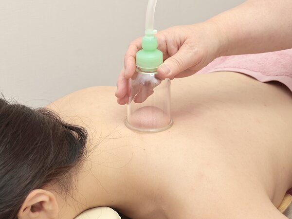 スライドカッピング|SA’S はりきゅうサロン