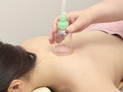 スライドカッピング|SA’S はりきゅうサロン