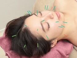 美容鍼|SA’S はりきゅうサロン