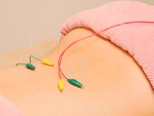 電気鍼|SA’S はりきゅうサロン