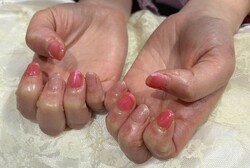 「ハンド 定額デザイン」お色味を春っぽいピンクに変更しました♪ さくらんぼカラーでとっても可愛いです^ ^|Nail Salon Linda