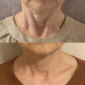 リフェイス -Re face-|Kalon