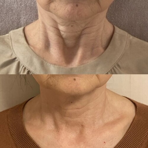 リフェイス -Re face-