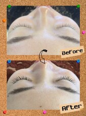 ラッシュアディクト|Kalon