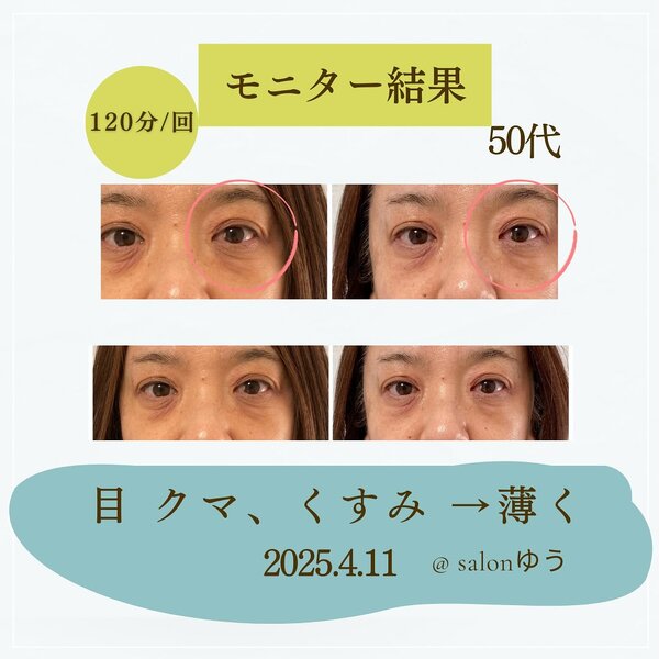 【Before/After】120分コース|salonゆう