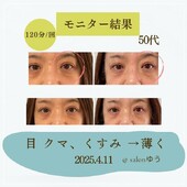 【Before/After】120分コース|salonゆう