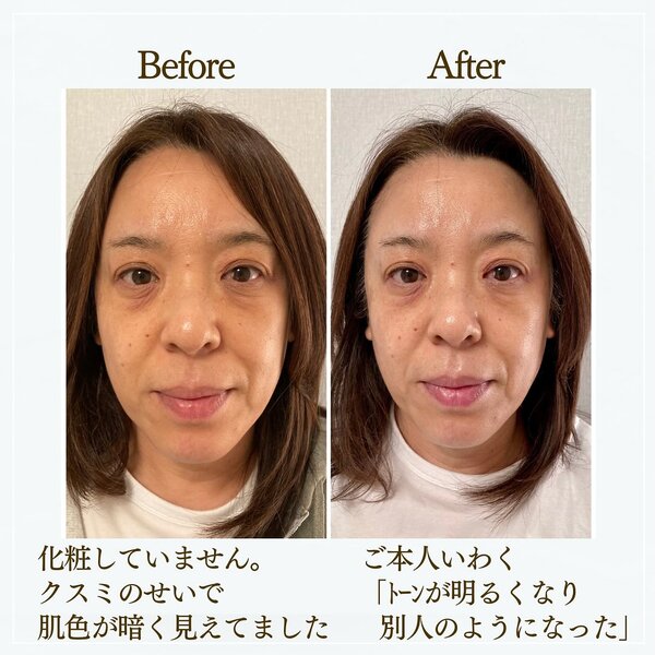【Before/After】120分コース|salonゆう