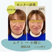 【Before/After】100分コース|salonゆう