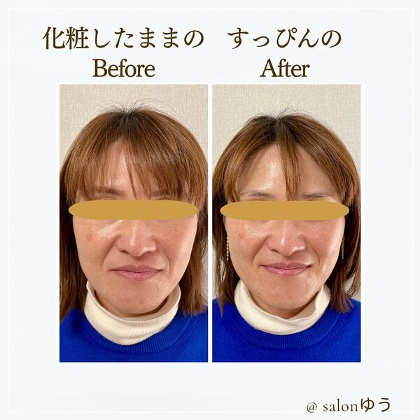 【Before/After】100分コース|salonゆう