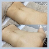 ボディハーブピーリング|aimer more 国立店