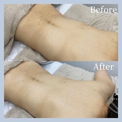 ボディハーブピーリング|aimer more 国立店