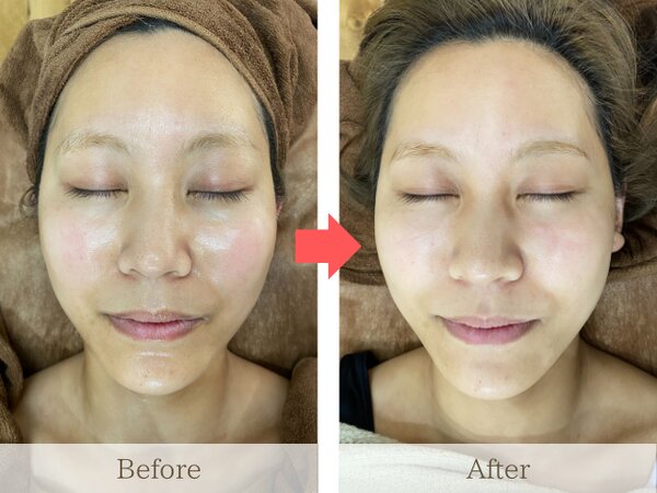 お顔そり美容法／シェービング|le`a salon