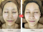 お顔そり美容法／シェービング|le`a salon