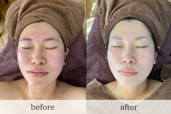 ブライダルシェービング|le`a salon