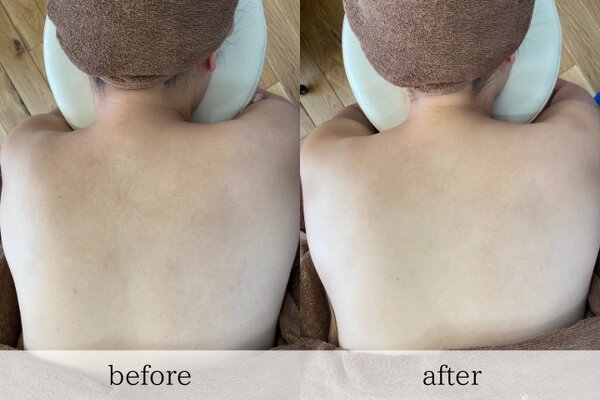 ブライダルシェービング|le`a salon