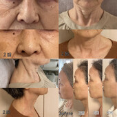 リフェイス-reface-|Kalon