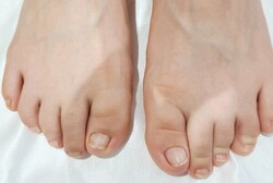 「フットケア」フット角質ケアでかかとから綺麗に！|Nail Salon Linda