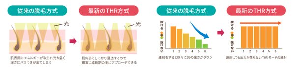 使用している脱毛機について|BLANCHE
