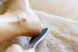 フットの角質ケア（角質除去）